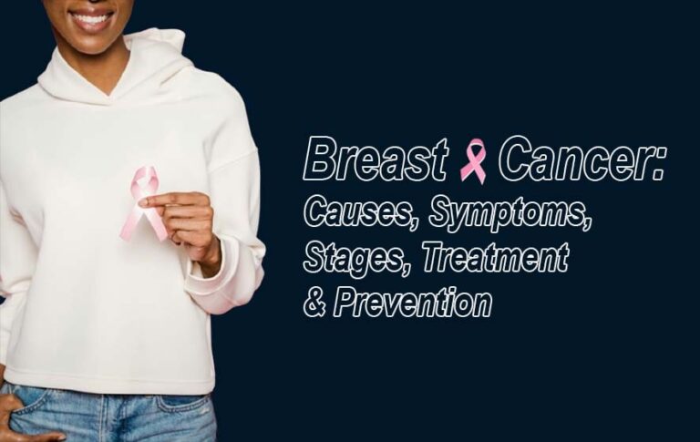 Breast Cancer: Causes, Symptoms, Stages, Treatment & Prevention 